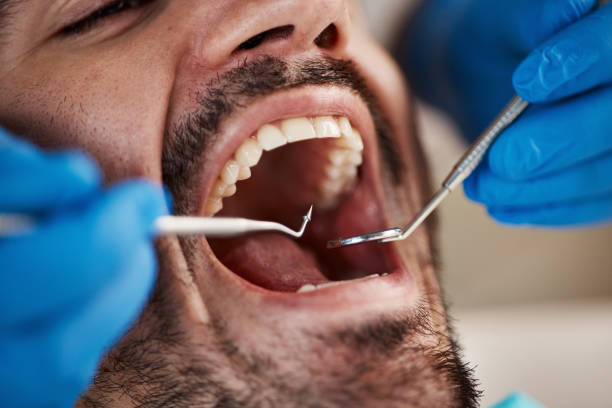 Best Teeth Whitening  in Spry, PA